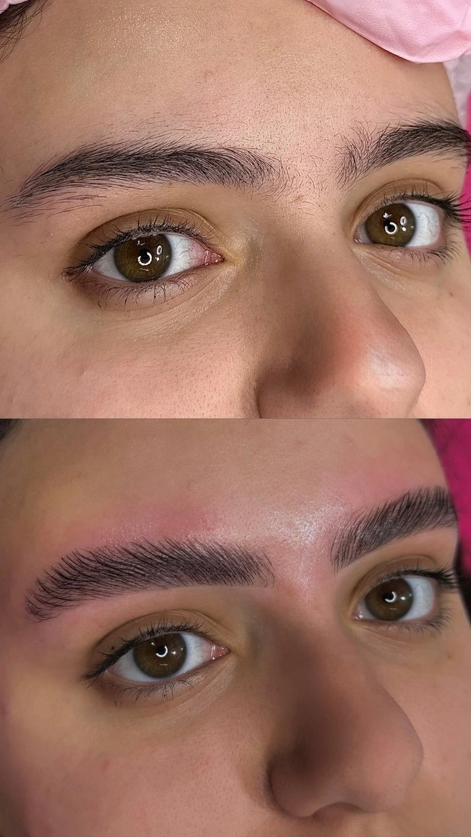 Brow Lamination